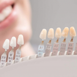 What Are The Different Types Of Dental Crowns?
