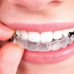 5 Reasons Why It’s Important To Look After Your Teeth