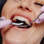 Gum disease: Treatments, Symptoms & Prevention