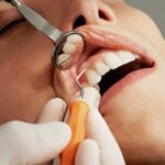 Dental Implants vs Dental Bridges: Which is better?